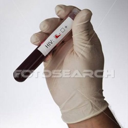 HIV e a “Campanha Fique Sabendo”