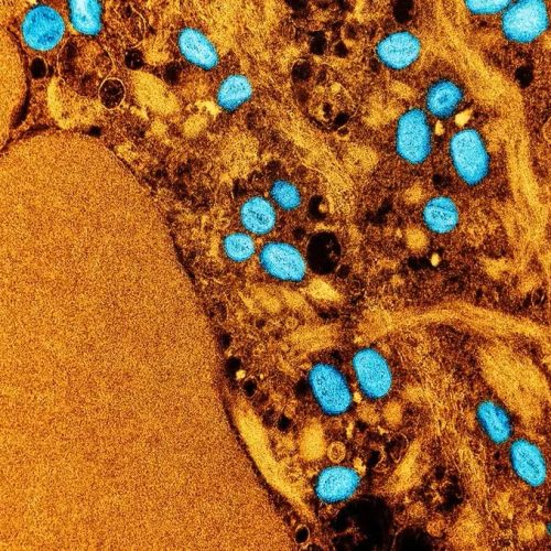 Cinco diagnósticos da doença de mpox são confirmados na região de Campinas (SP) em 2026