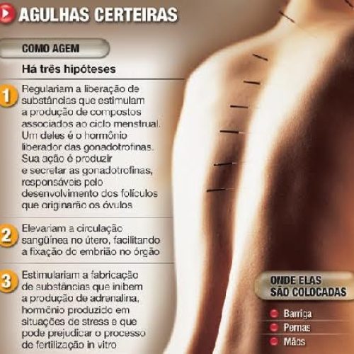 Espaço Buona Vita – Acupuntura Sistêmica e Auricular e Ventosaterapia:
