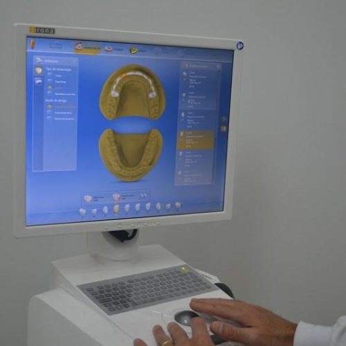 Odontologia Digital CAD/CAM – CEREC