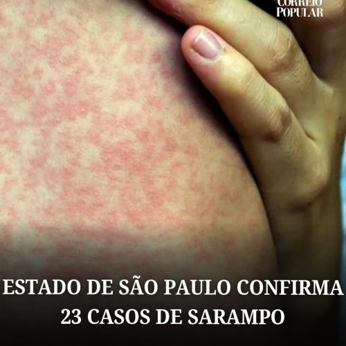 Alerta contra o negacionismo: governo de SP confirma 23 casos de sarampo e amplia vacinação