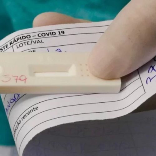 Nova variante da Covid-19, XFG, causa rouquidão e acende alerta médico