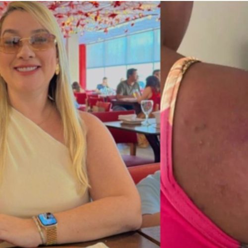 Empresária suspeita de agredir e torturar doméstica grávida de 19 anos é presa no Piauí