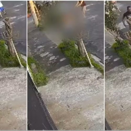 Menino de 12 anos fica gravemente ferido após ataque de pitbull em São Carlos