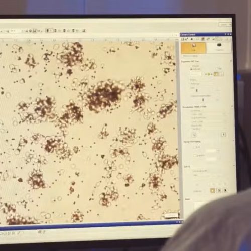 Terapia Car-T contra o câncer pode ter registro na Anvisa em 2026