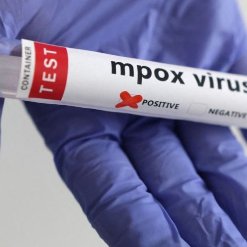 Mpox avança no Brasil e casos já passam de 120 em 2026; estado de SP concentra dois terços das confirmações