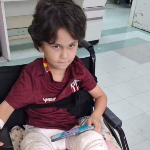 Menino que caiu do 10º andar em Ribeirão Preto recebe alta hospitalar