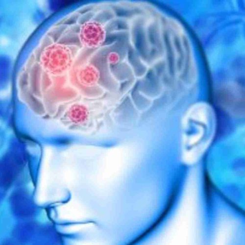 Casos de Meningite Bacteriana na região acendem alerta sobre prevenção e sintomas