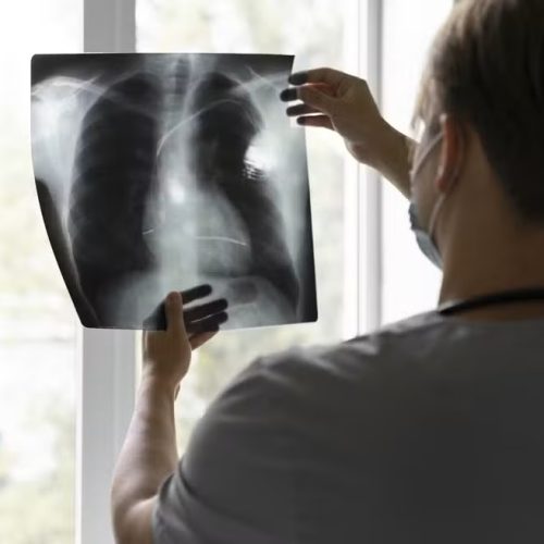 Araras é a terceira cidade do estado de São Paulo com mais mortes por câncer, aponta levantamento