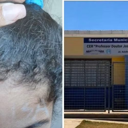Mãe denuncia que professora escreveu “boba” na testa de menina de 4 anos em Araraquara