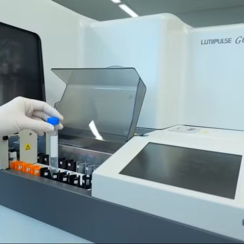 Exame de sangue para Alzheimer chega ao Brasil e custa cerca de R$ 3 mil